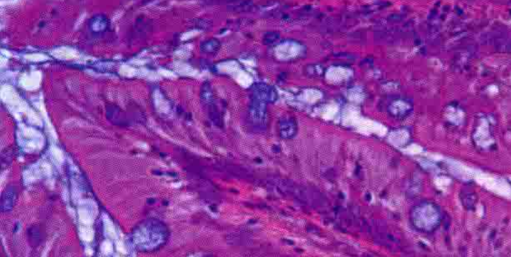 The transverse of anterior intestine